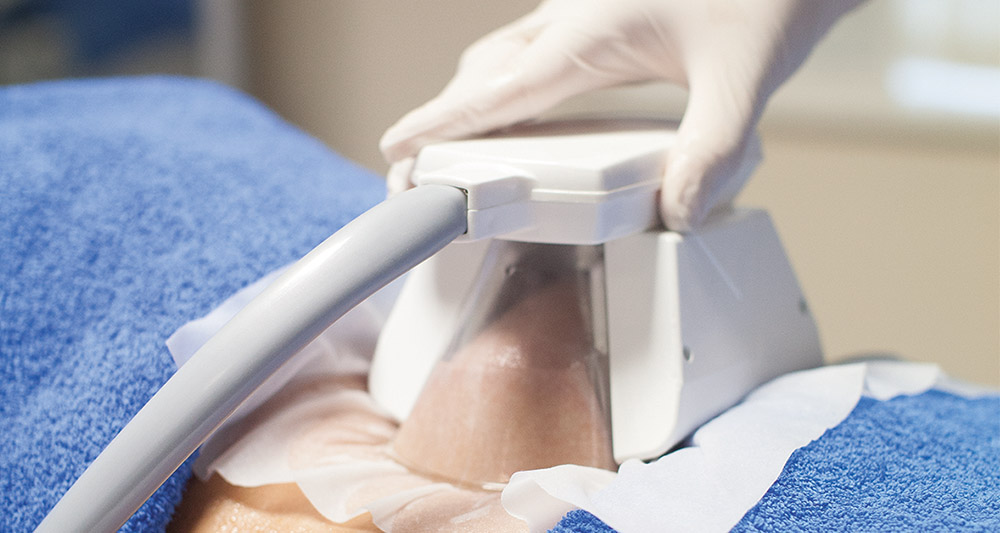 How Fat Freezing and HIFU Work Together? 2 Multiple Areas in One Session HIFU and Fat Freezing Bedfordshire