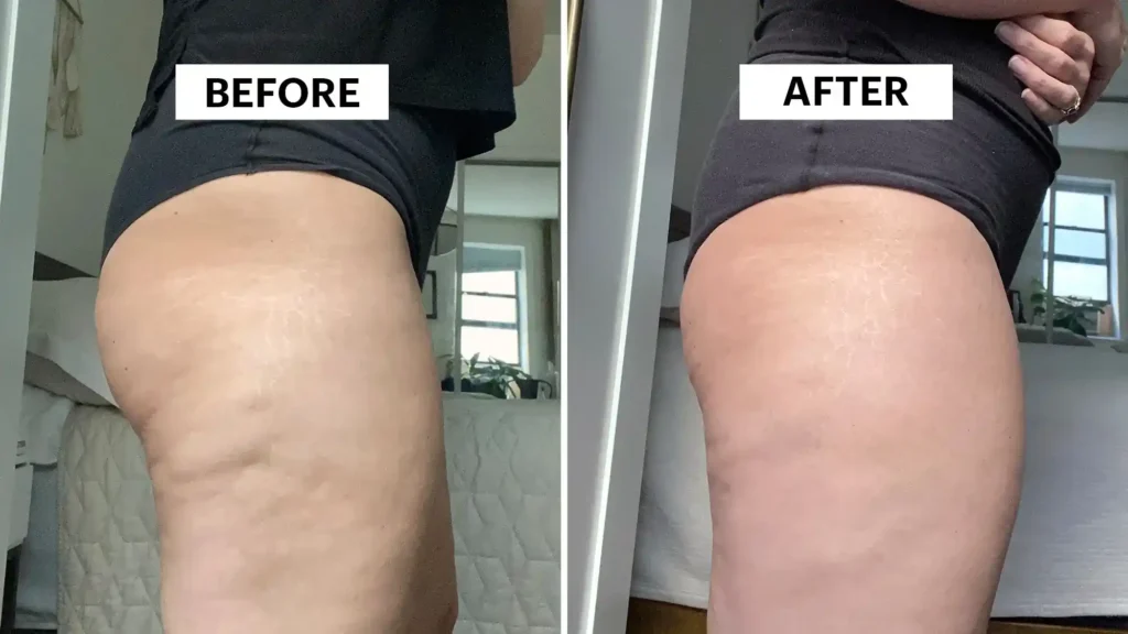 Do Toning Exercise Bedfordshire Really Tackle Cellulite?