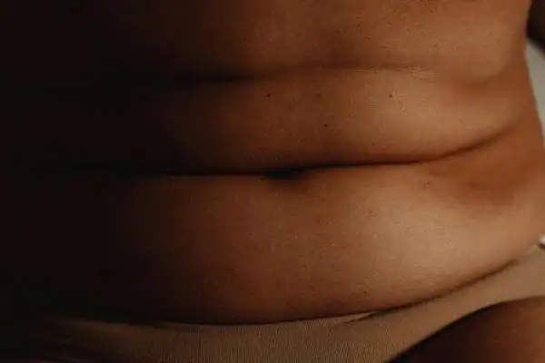 The Hidden Connection: How Stress Shapes Your Fitness and Body Composition 3 image of what stress can do on the stomach area and how Lipo 360 Bedfordshire can help to change your body shape.