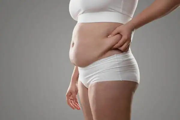 Image of stress belly Bedfordshire How Lipo 360 can help manage your symptoms